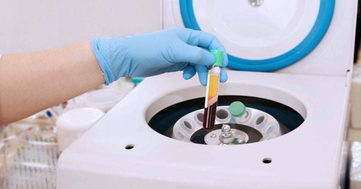 A lab using a cnterfuge to separate a red liquid in test tubes.