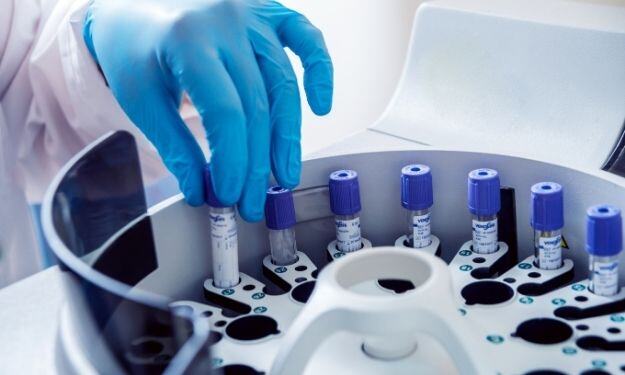 Tips for Purchasing Used Laboratory Equipment