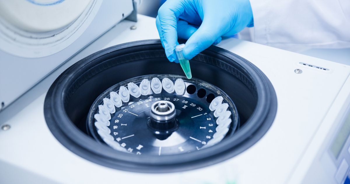 When to Use a Centrifuge Instead of Filtration
